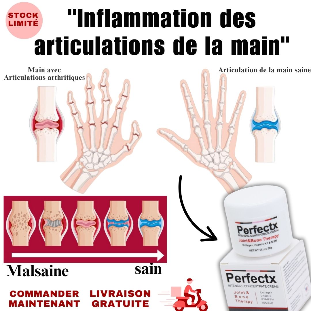 🇬🇳 La Crème  Perfectx Intensive.       L'OPTION N°1 POUR LUTTER CONTRE LES PROBLÈMES ARTICULAIRES ET OSSEUX